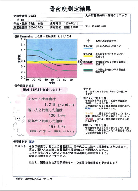 骨密度測定検査結果(59歳)